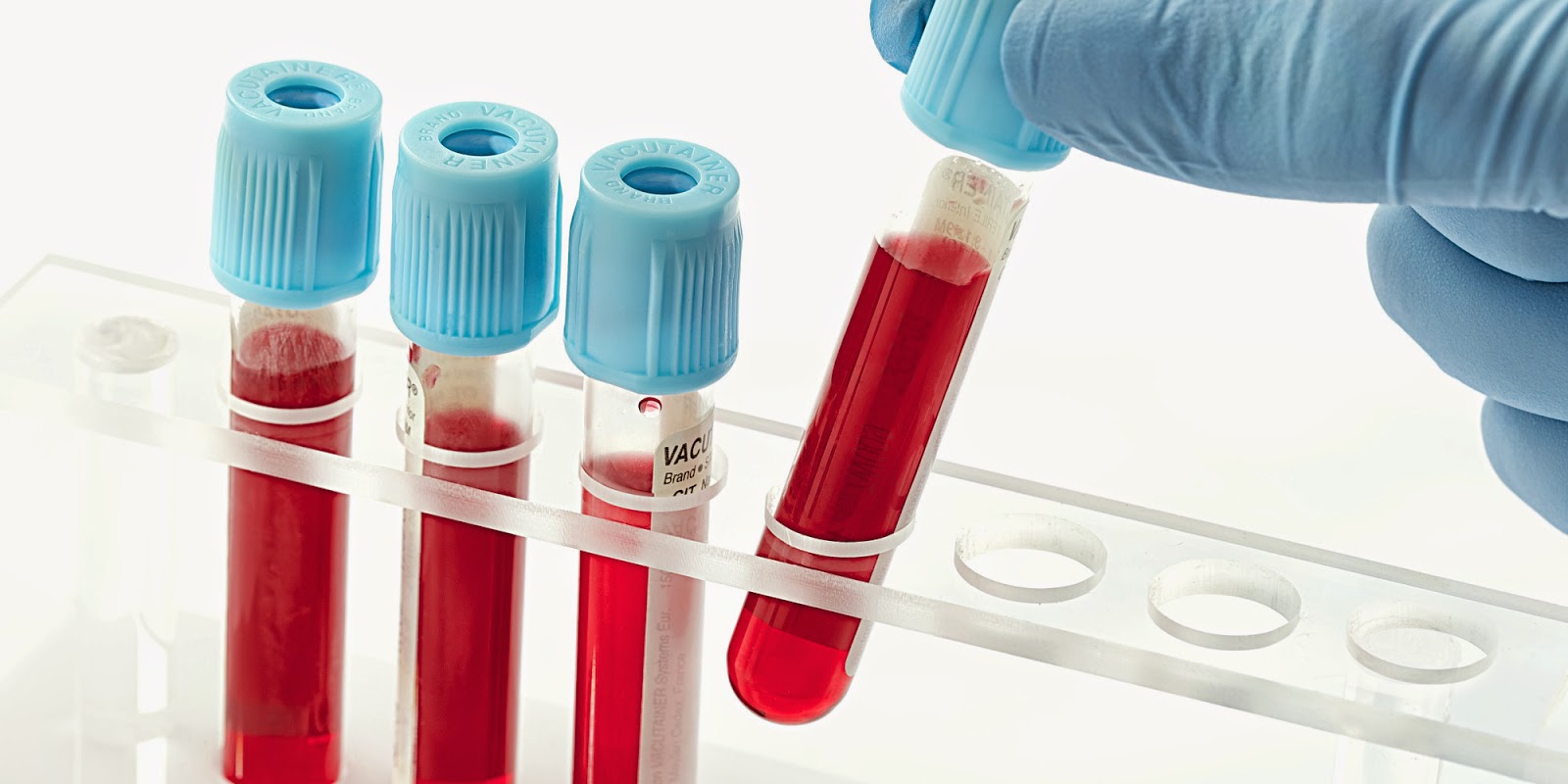 o-BLOOD-TEST-facebook